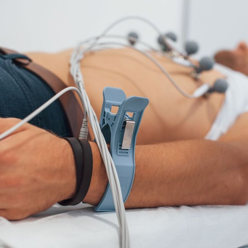 Eletrocardiograma (ECG)