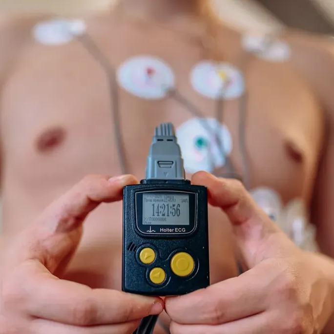 Holter 24h